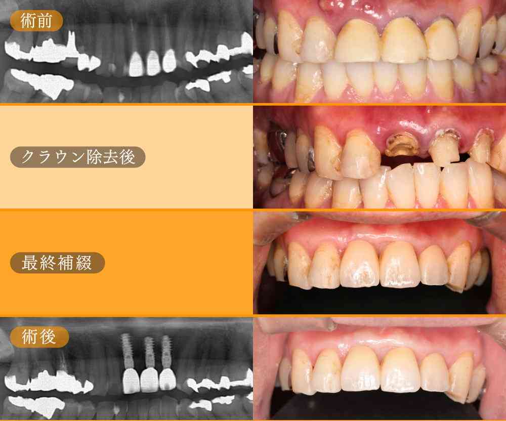 記事サムネイル