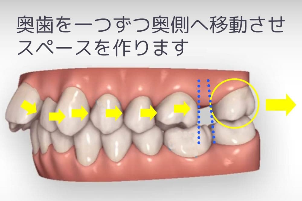 矯正歯科