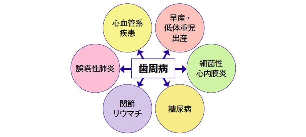 ⁨歯周病治療