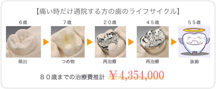 予防歯科診療