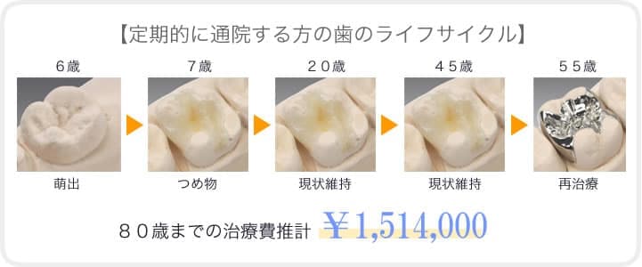 予防歯科診療