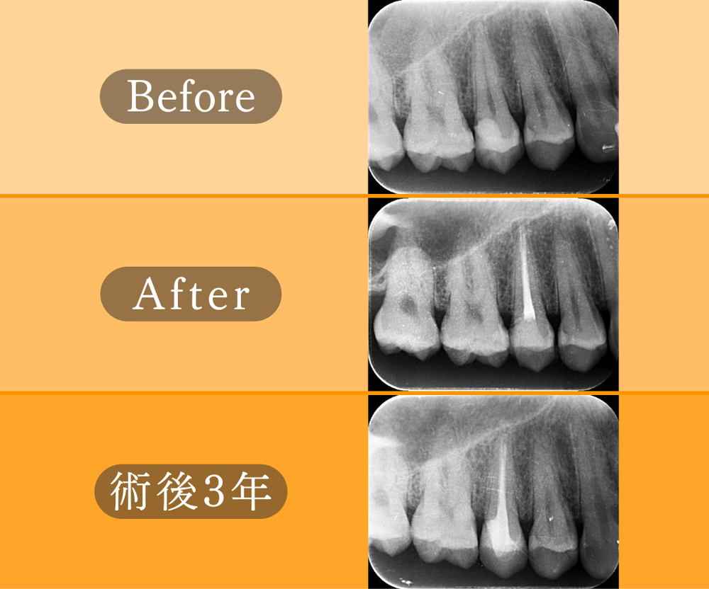 記事サムネイル