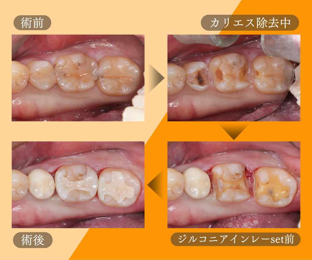 記事サムネイル