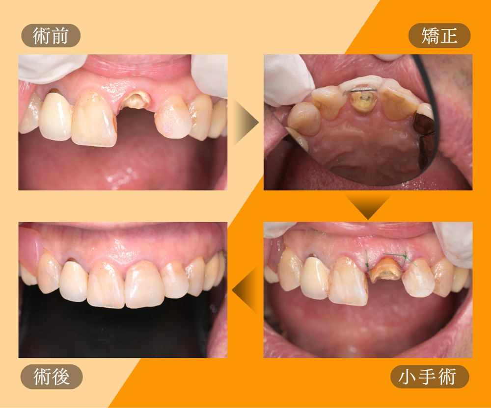 記事サムネイル